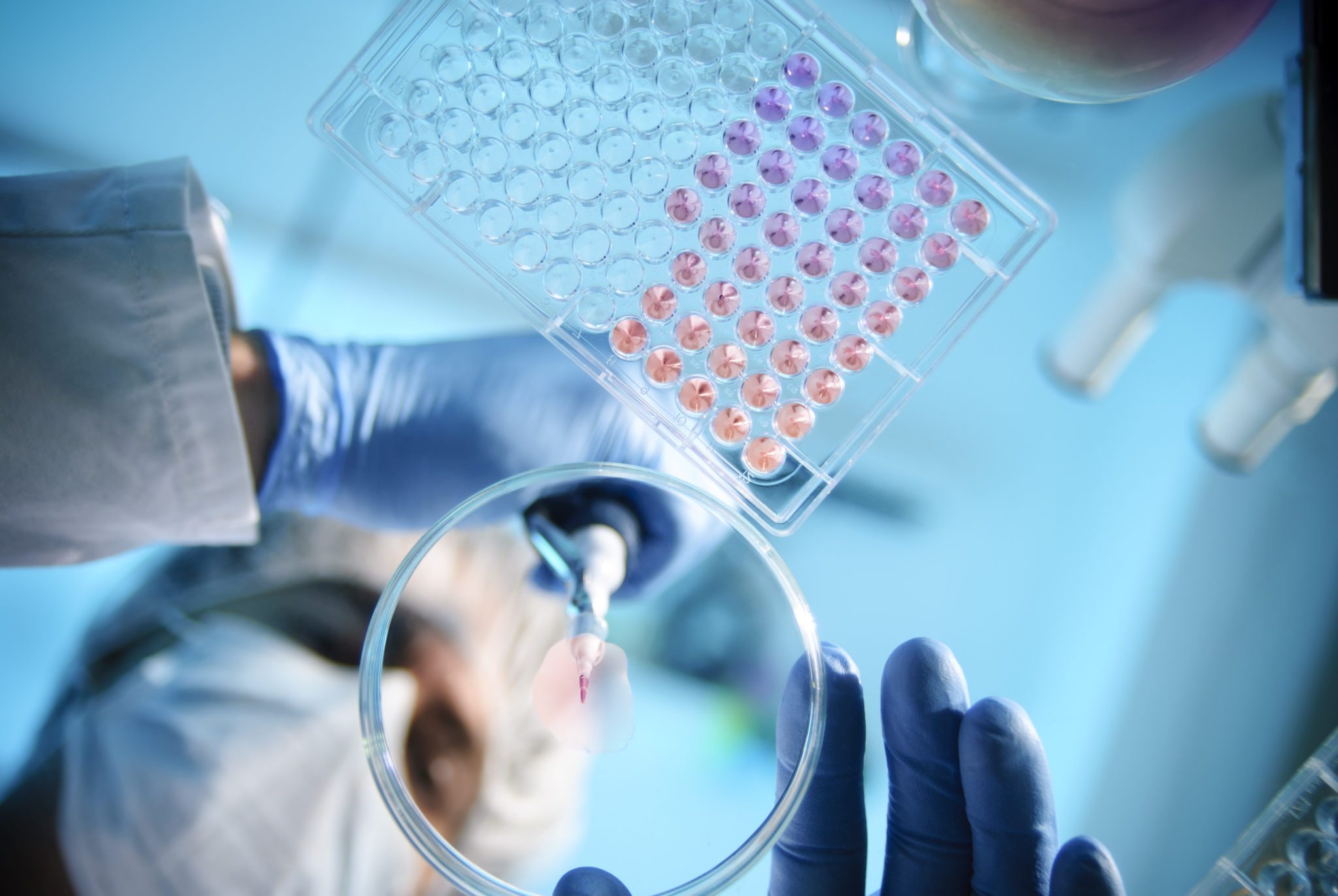 medical lab equipment. a lab tech holding a dropper with liquid dropping it into a tablet with small compartments with colorful fluids