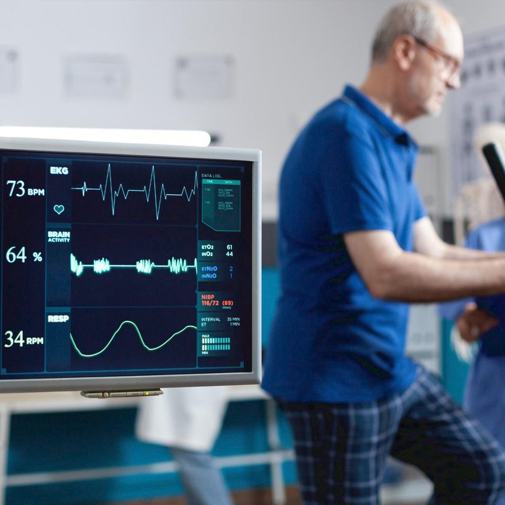 Atrial Fibrillation3