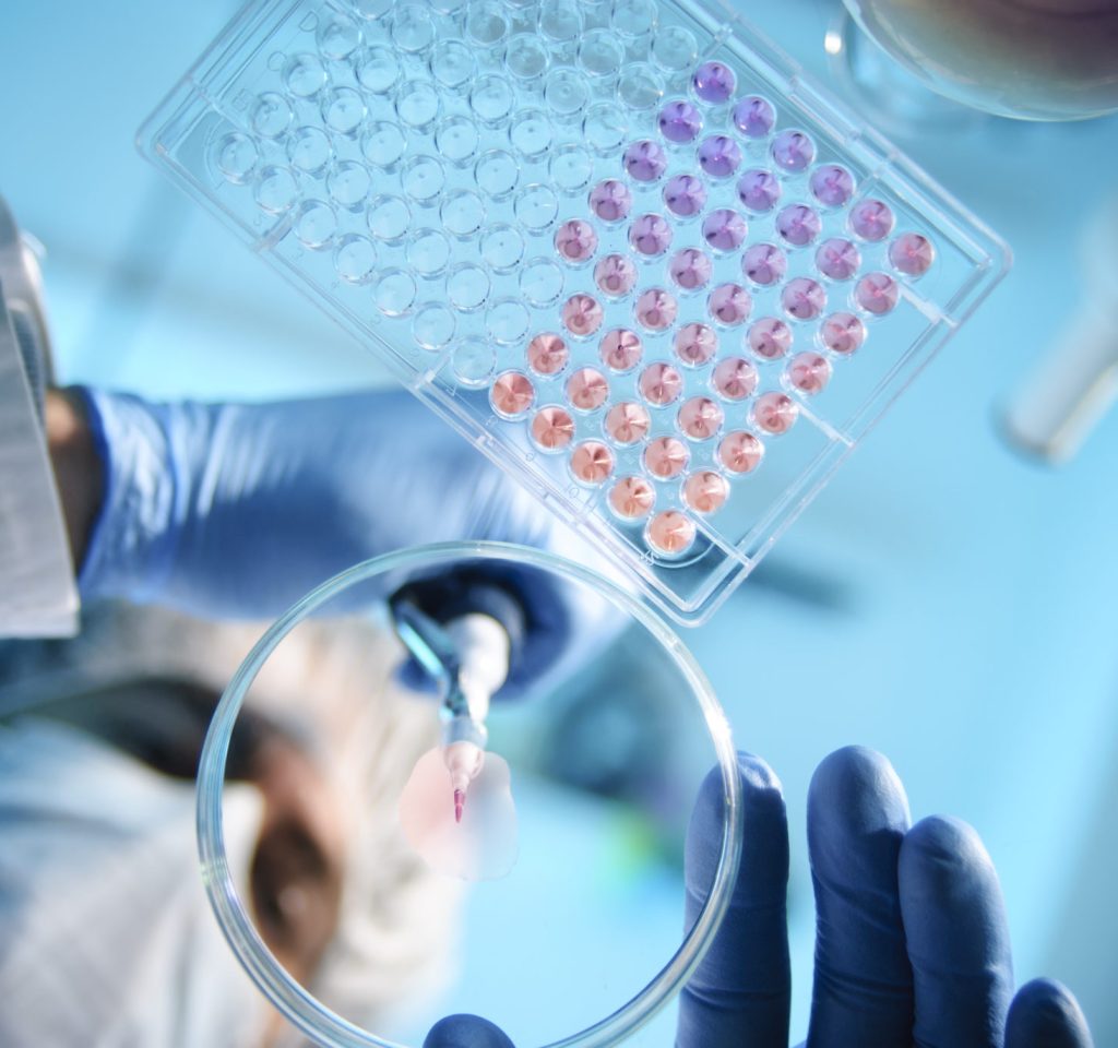 medical lab equipment. a lab tech holding a dropper with liquid dropping it into a tablet with small compartments with colorful fluids